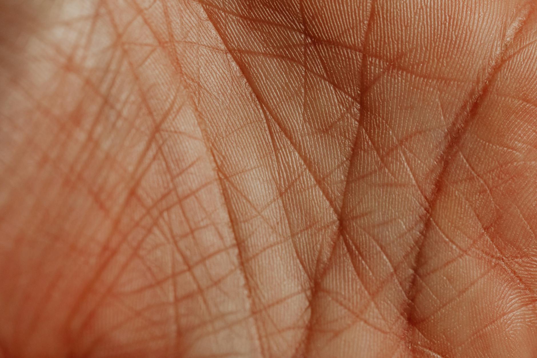 Why Nerve Compression Is the Critical Factor Determining Disc Pain