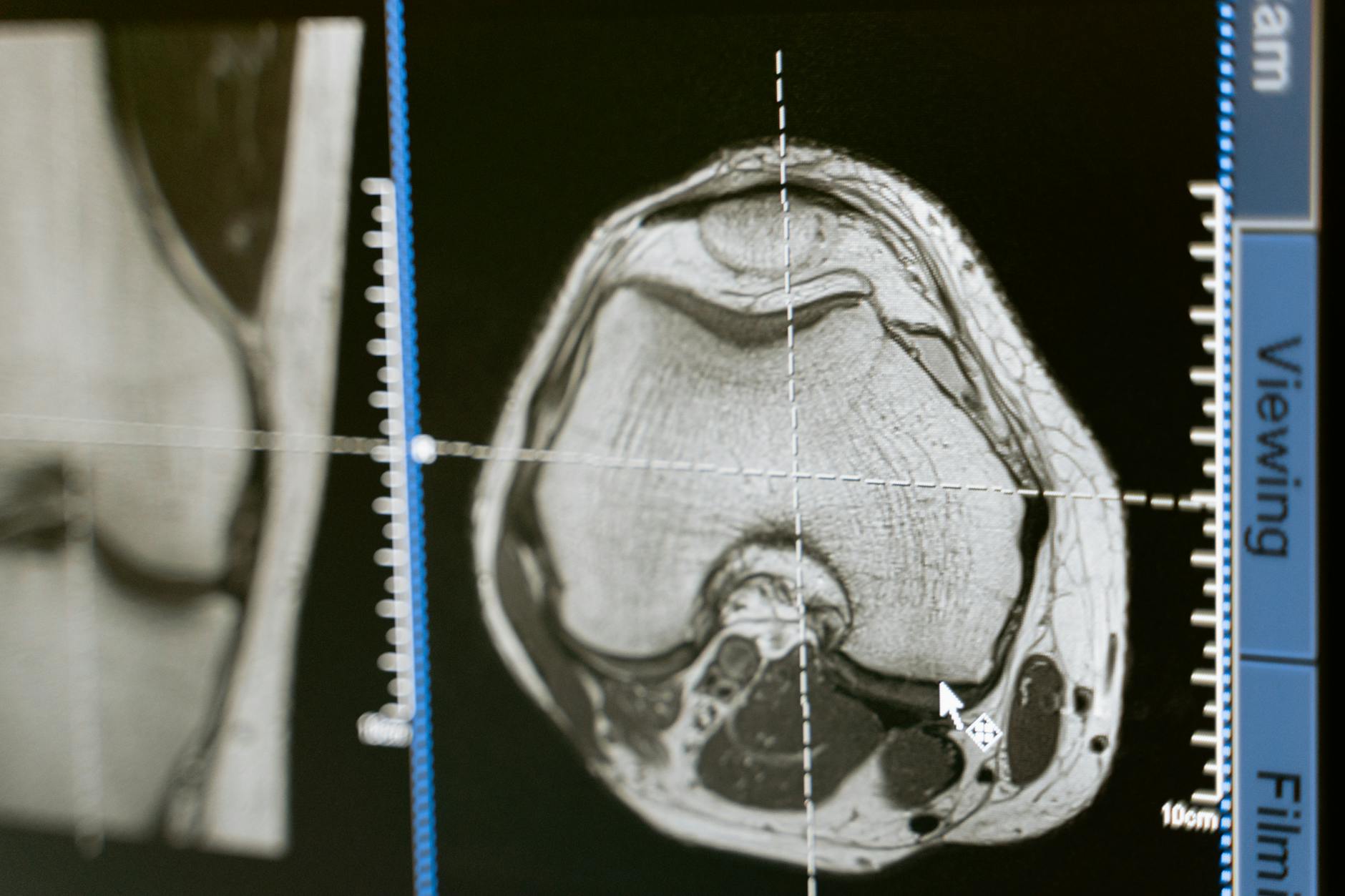 Advanced Imaging Techniques Revealing Structural Brain Changes