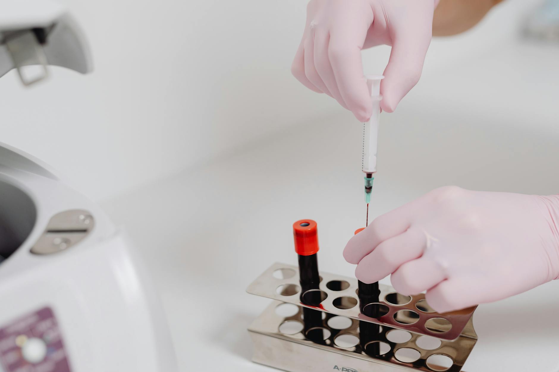 Brain Blood Flow Studies—The Strongest Evidence, Still Limited