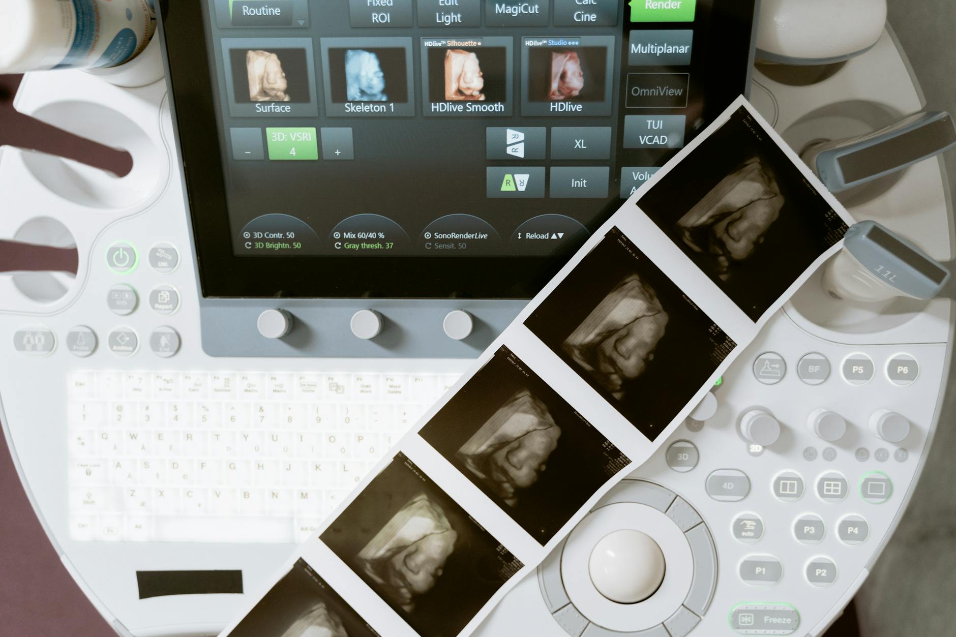 Different Imaging Modalities and What They Reveal