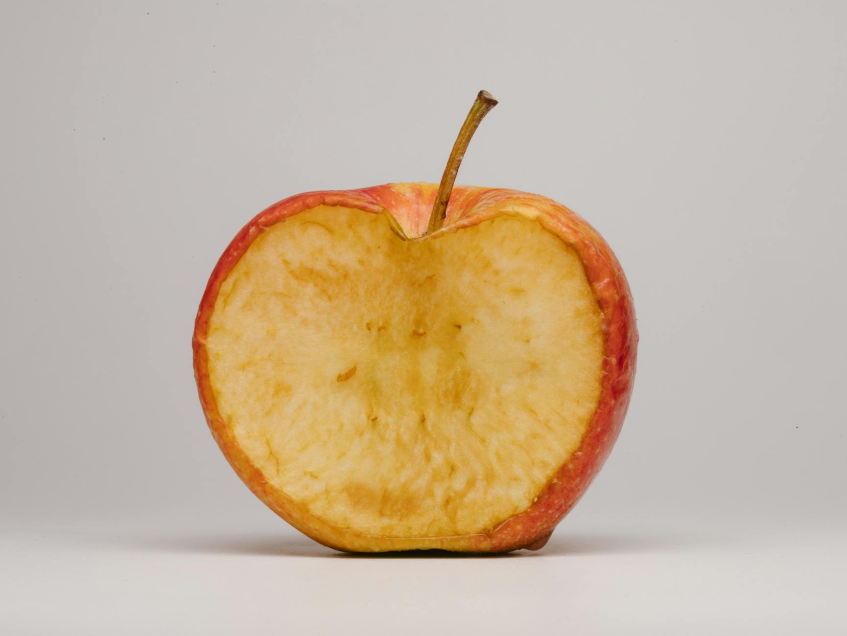 Fast Food Versus Unprocessed Meat—Why the Distinction Matters