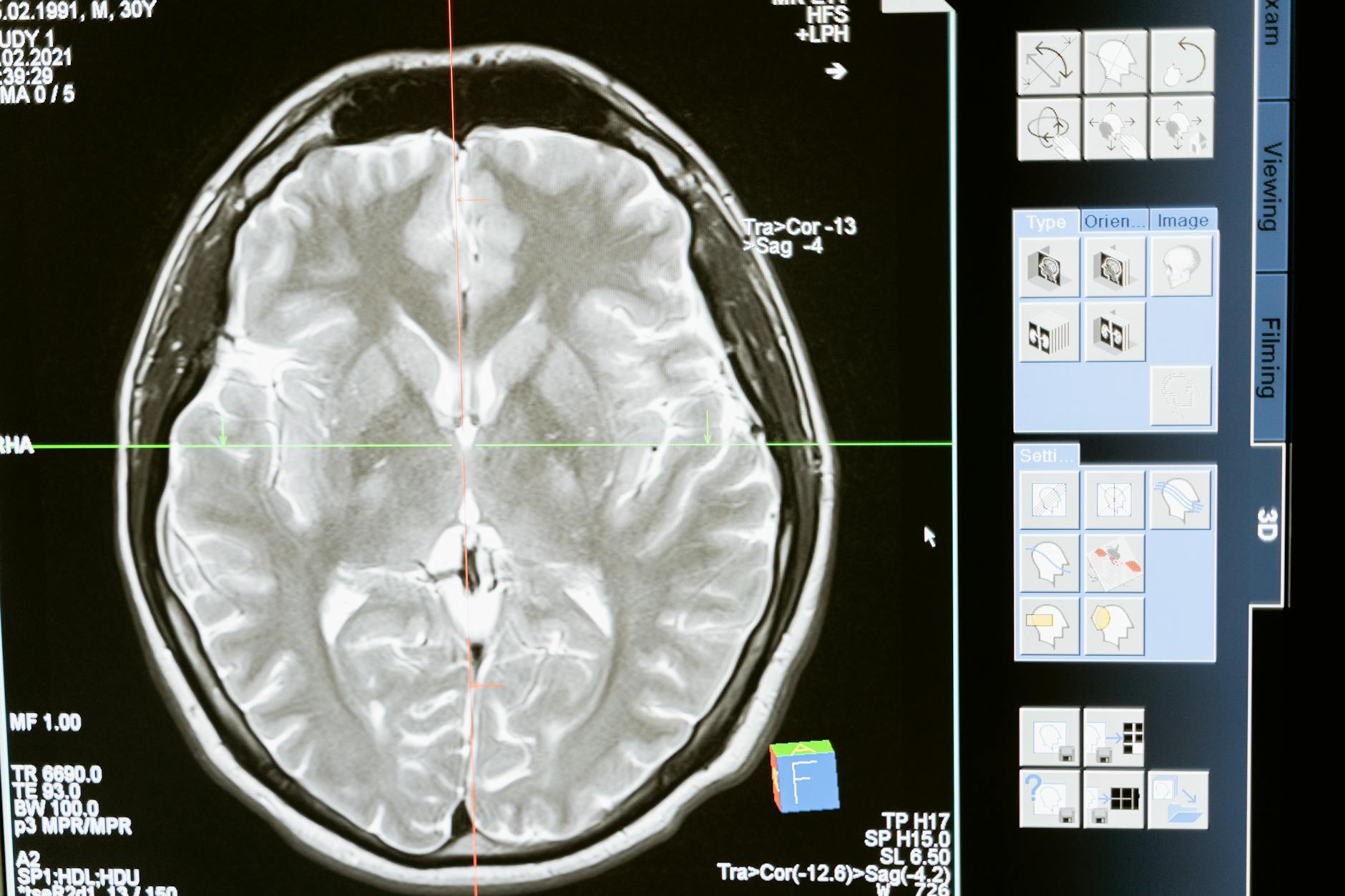 Gene-Specific Brain Benefits: Why Some People See Bigger Gains