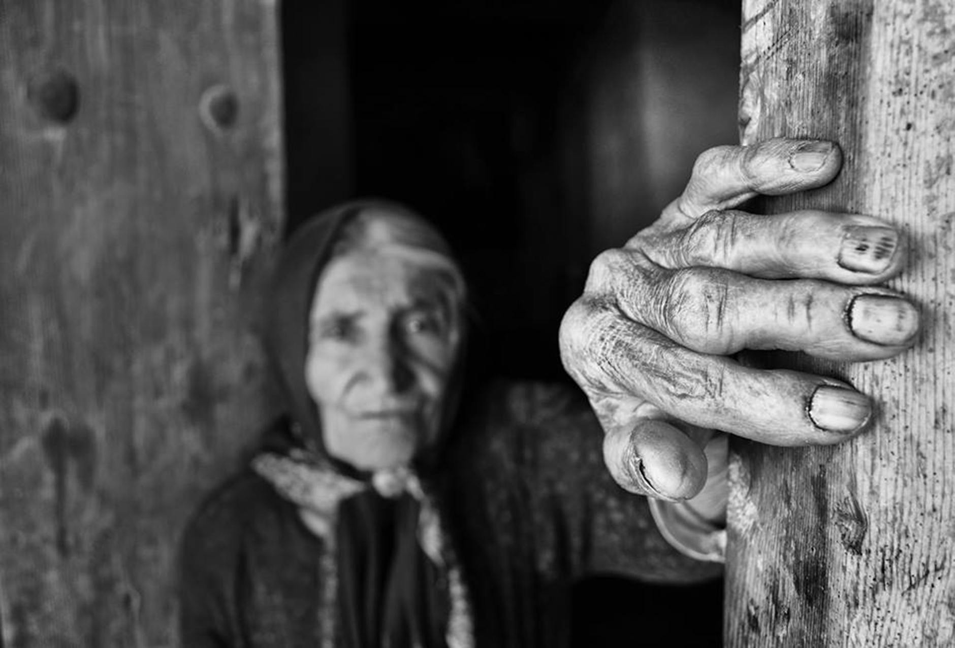 How Age Dramatically Escalates Your Alzheimer's Risk