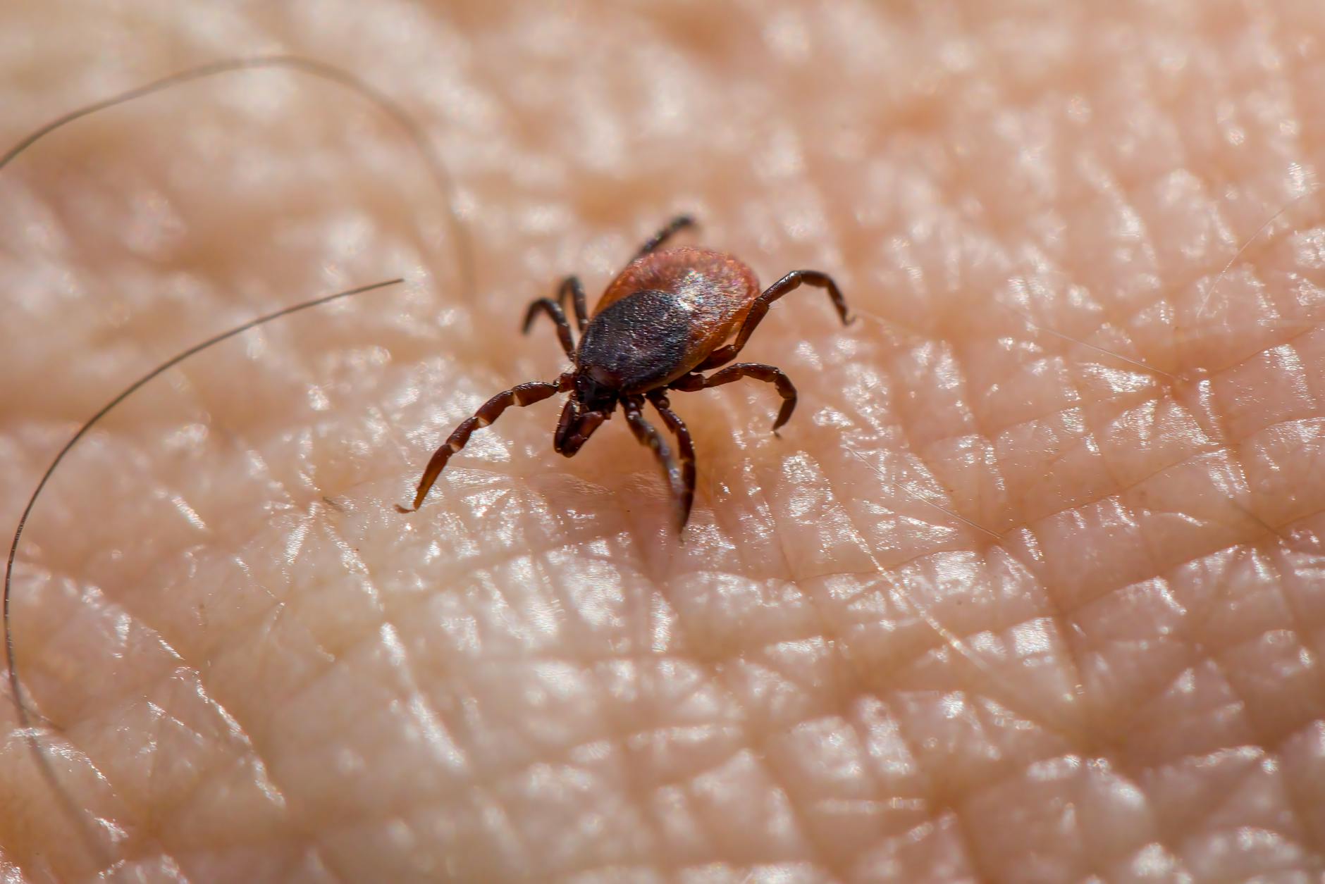 How Are Disease Stages Being Reclassified?