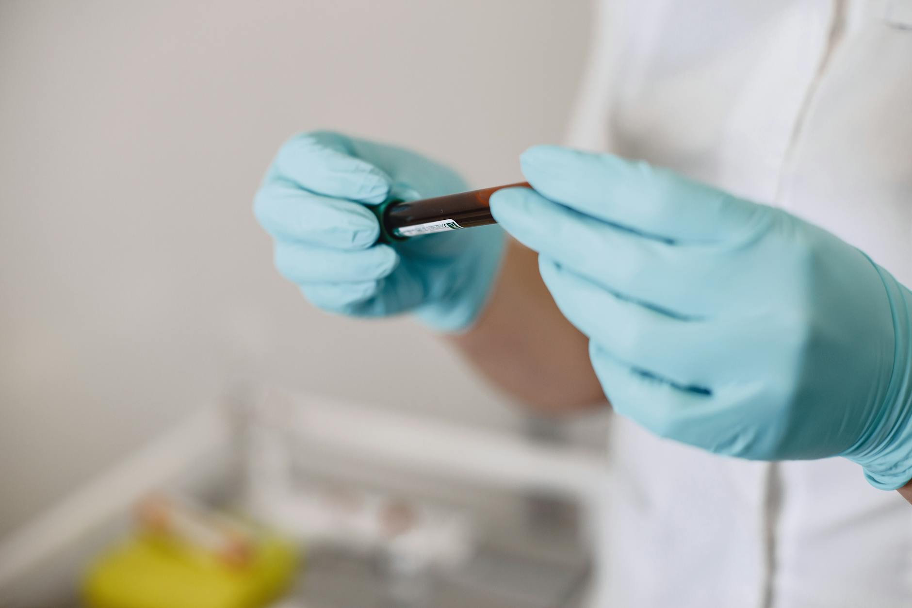 How Blood Tests Are Revolutionizing Alzheimer's Detection