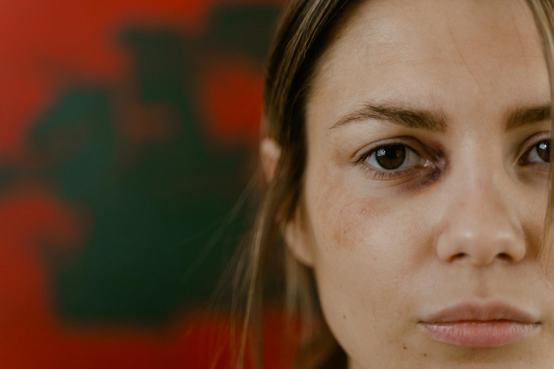 How Do Head Injuries Damage the Brain and Increase Dementia Risk?