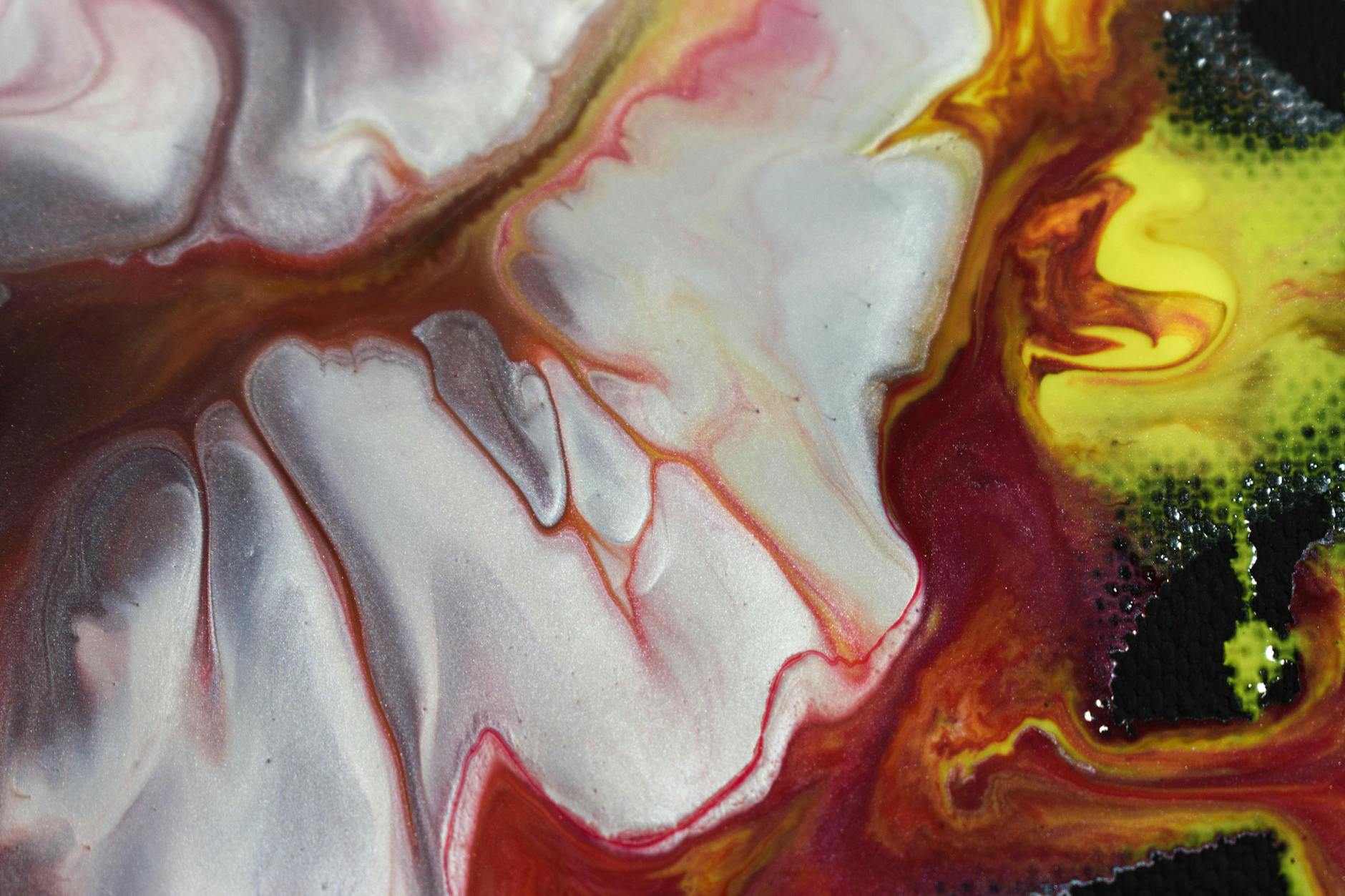 HOW DOES BRAIN INFLAMMATION TRIGGER ALZHEIMER'S?