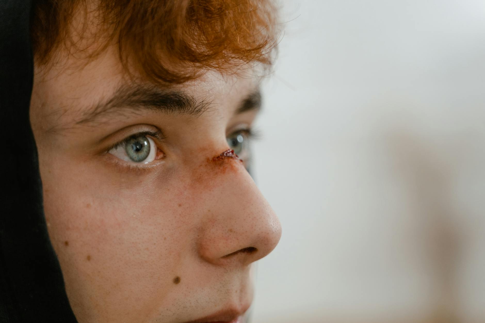 How Head Injuries Connect to Dementia Risk