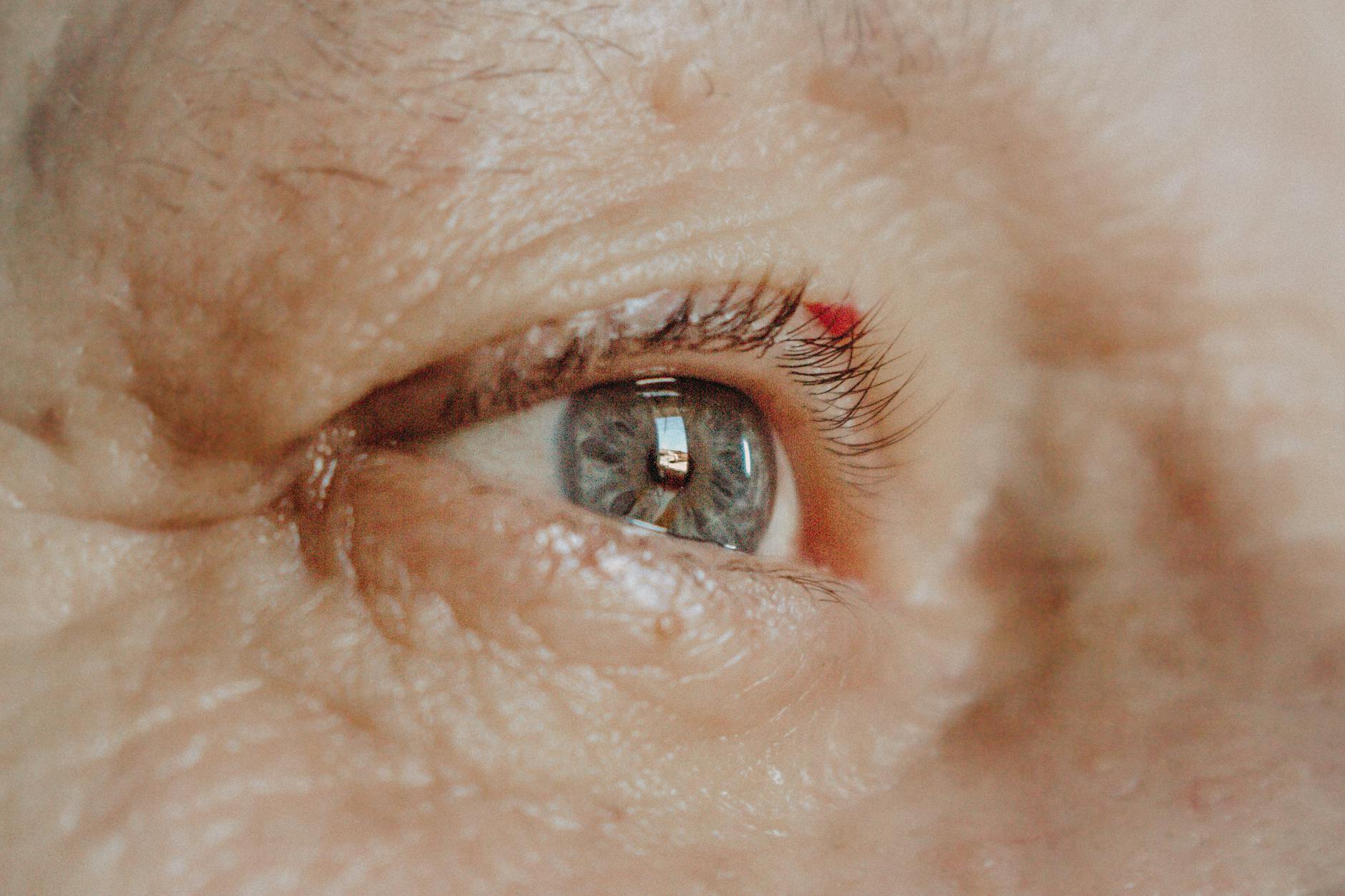How Much Can Alzheimer's Progression Actually Be Slowed?
