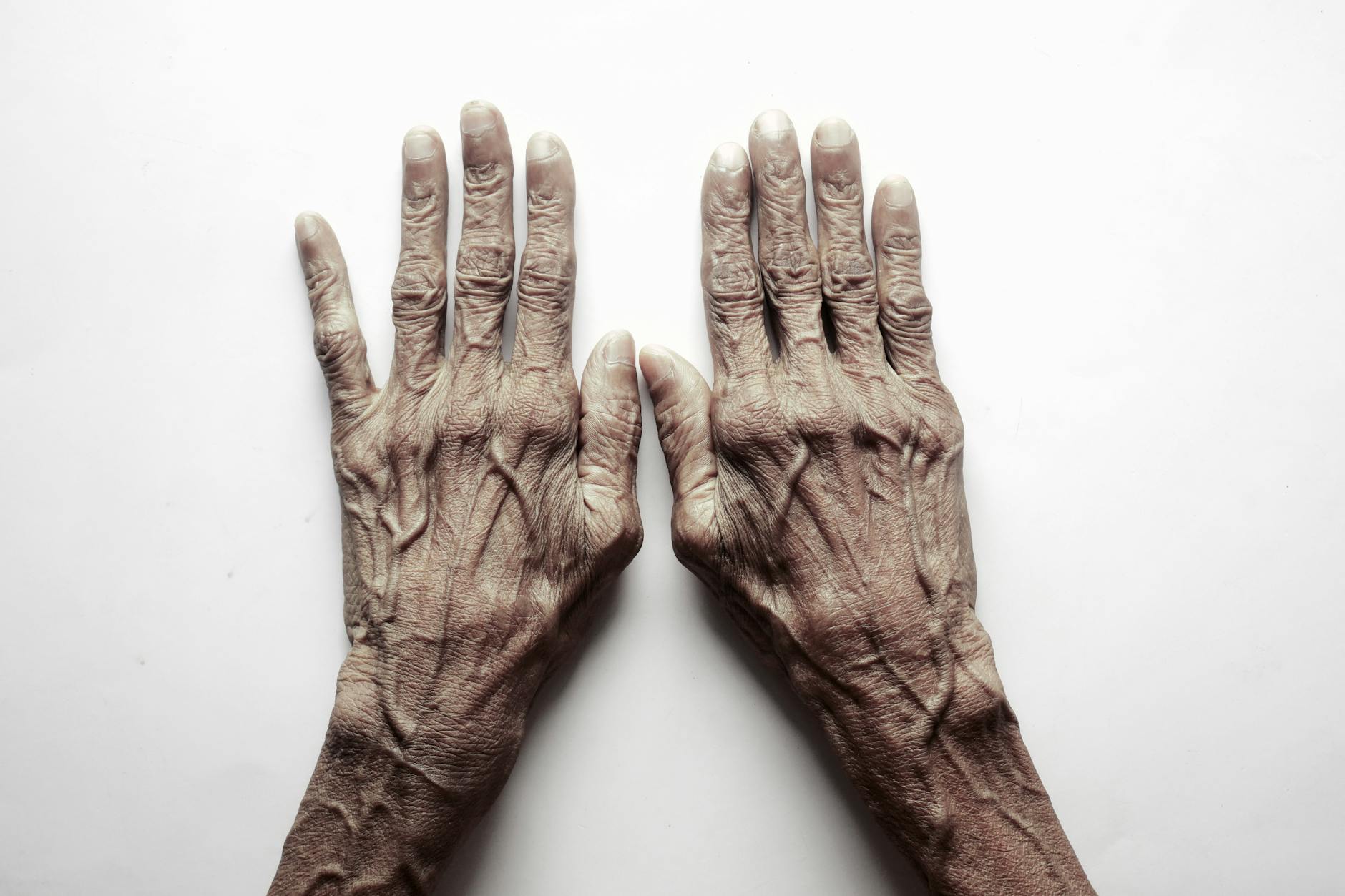 Realistic Expectations—What Prevention Cannot (Yet) Do