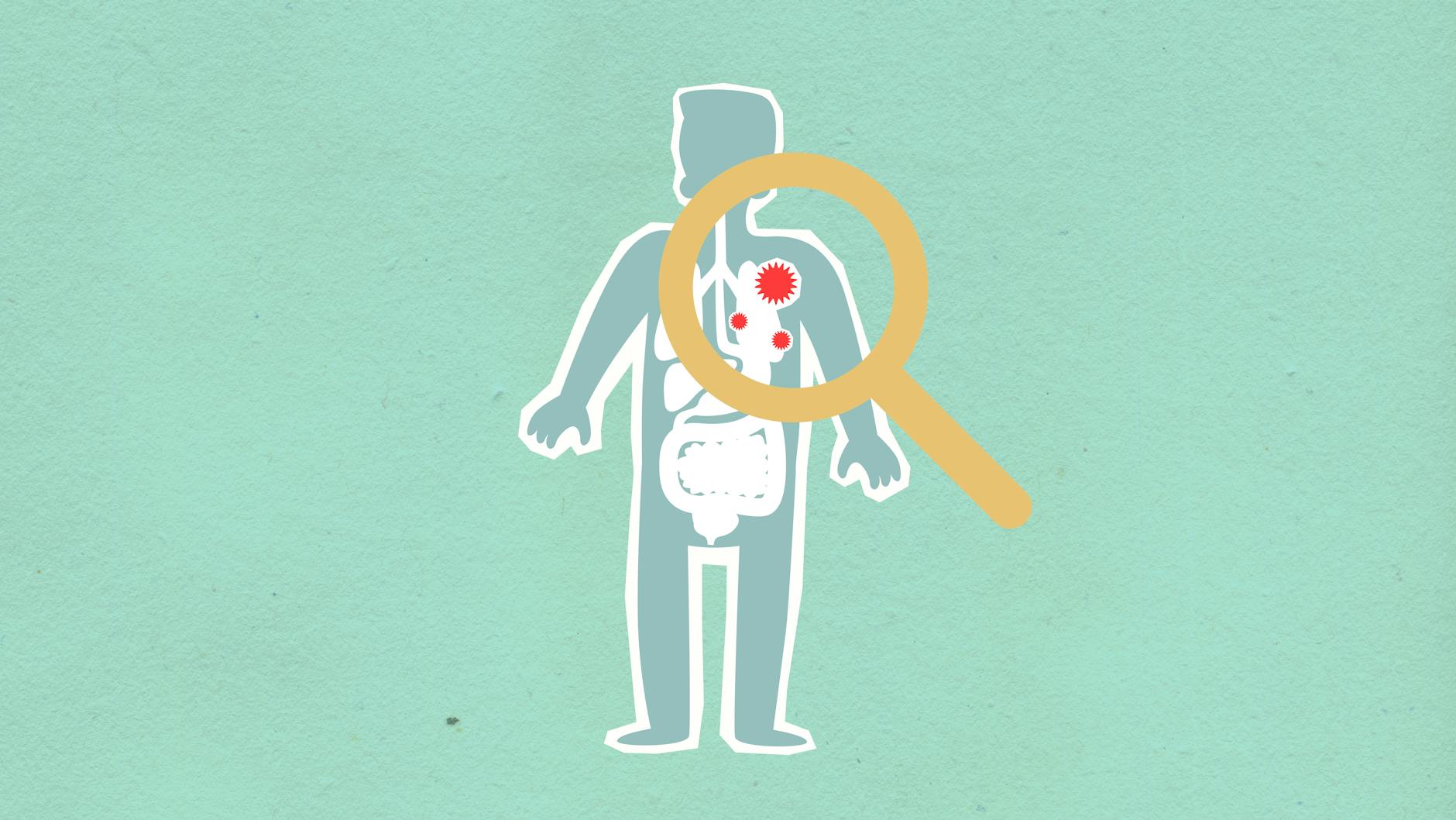 The Broader Gut Microbiome Picture and Cognitive Function