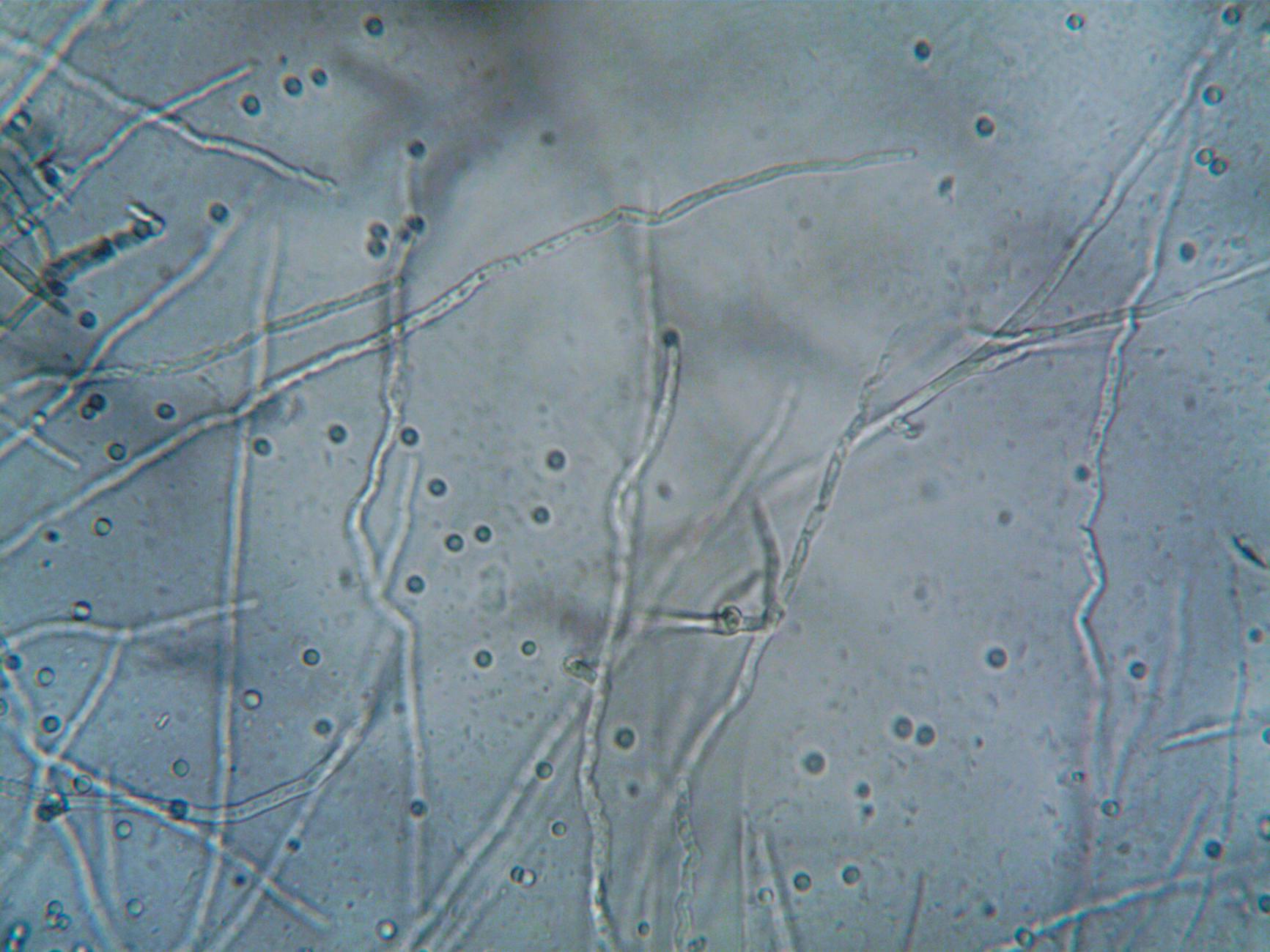 The Gut-Brain Axis and Microbial Communication