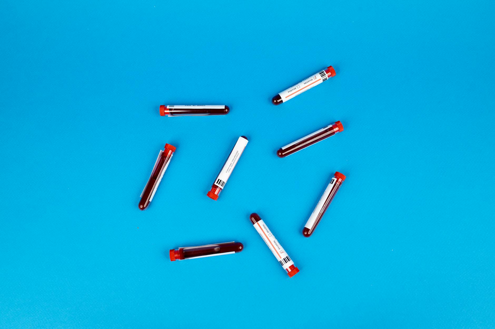 What Can Blood Tests Reveal About Alzheimer's Before Symptoms Appear?