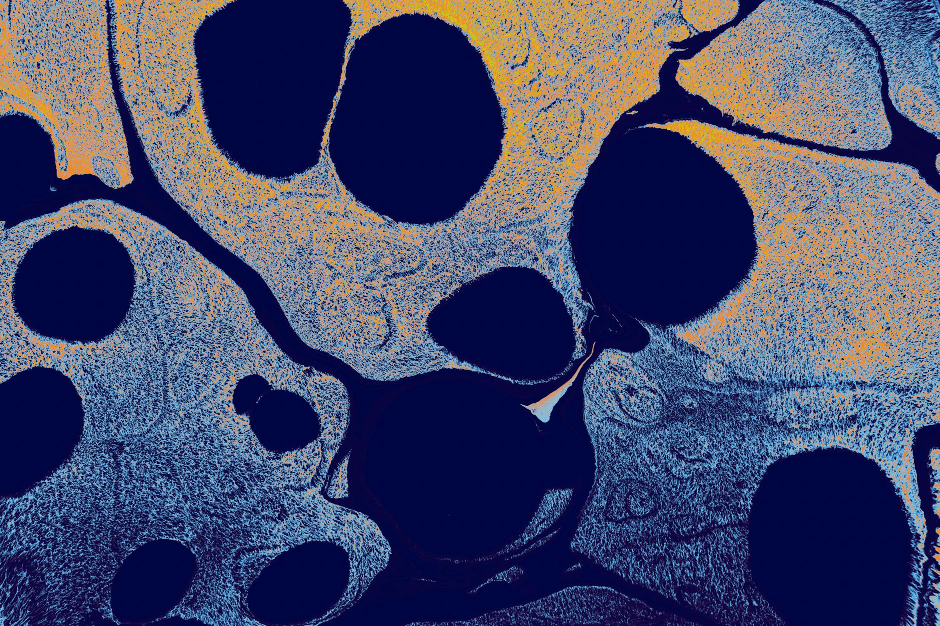 What Is Neuroinflammation and How Does It Drive Alzheimer's Disease?