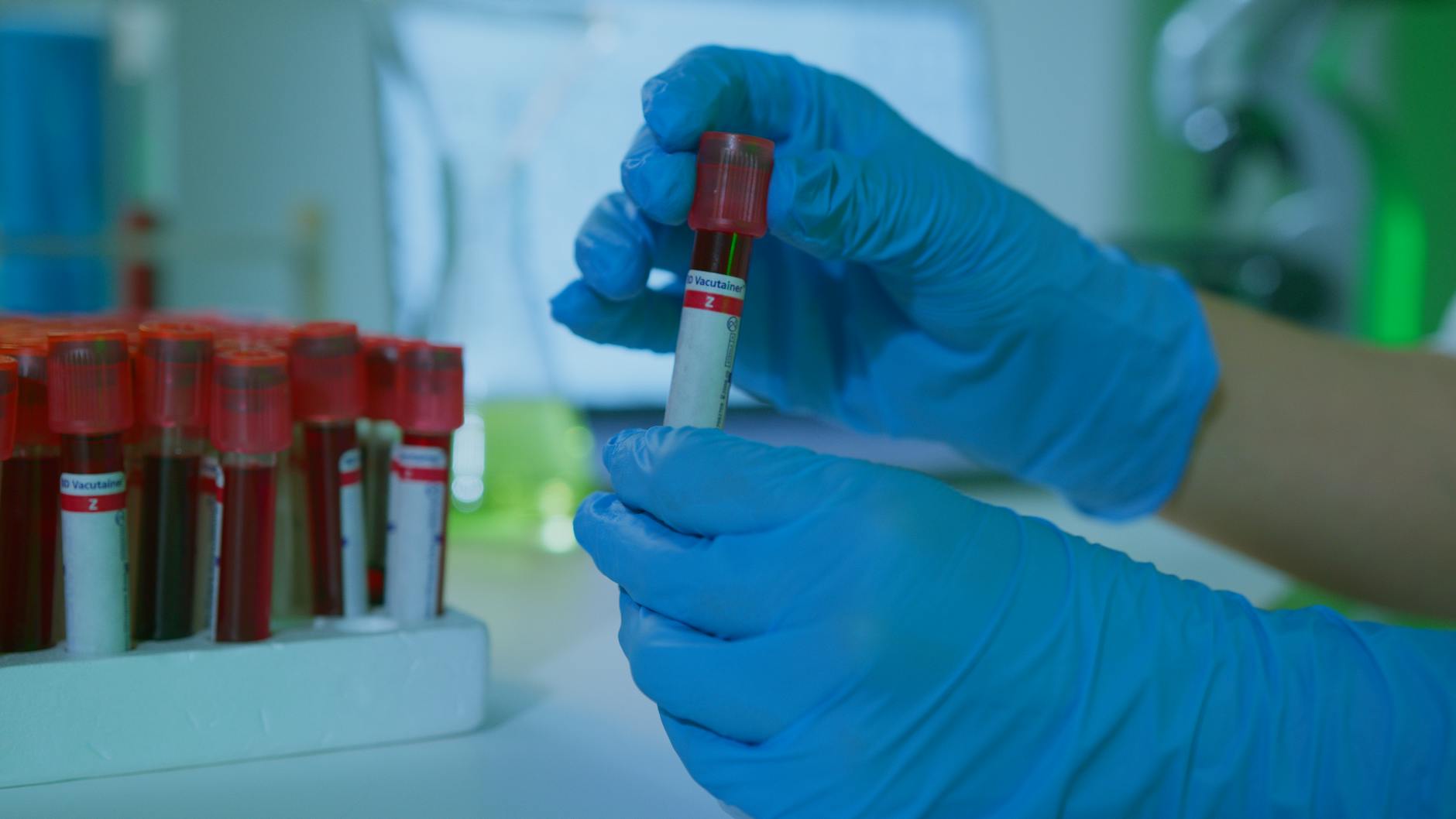 What Research Studies Show About Blood Sugar and Dementia Prevention