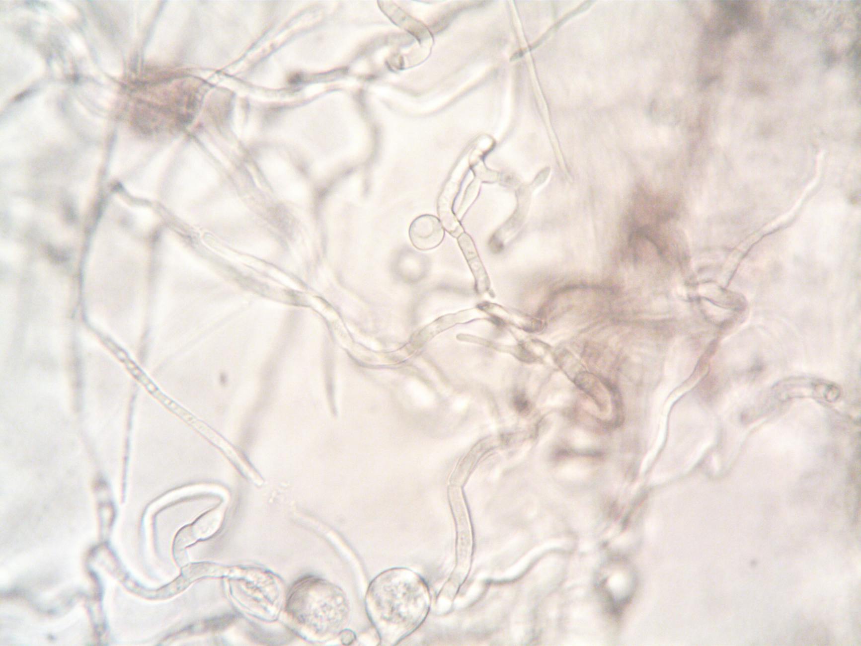What Role Do B Cells Play in Alzheimer's Development?