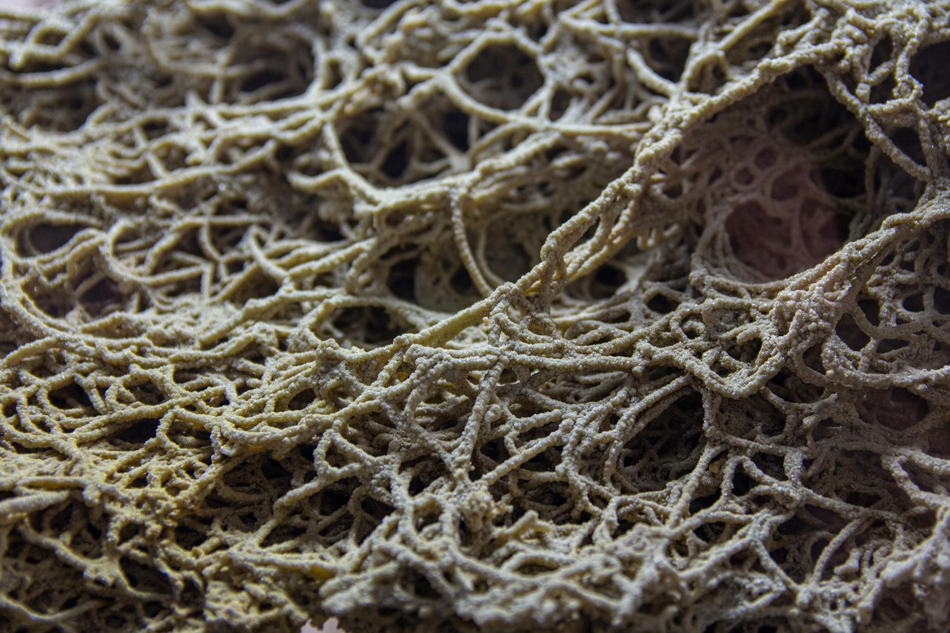 What Structural Changes Actually Occur in Alzheimer's Brains?
