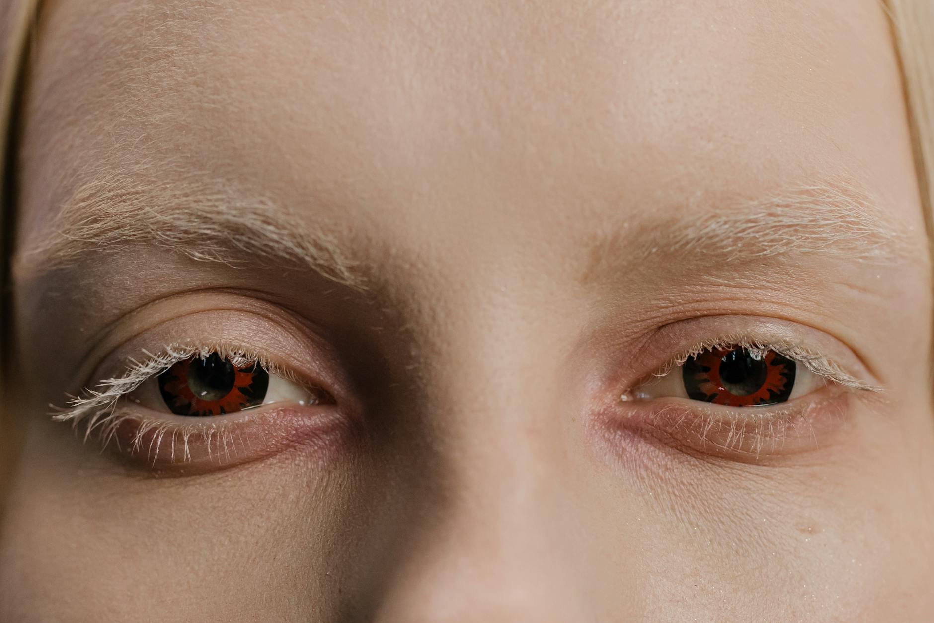 When Does Personality Change Become a Medical Concern?