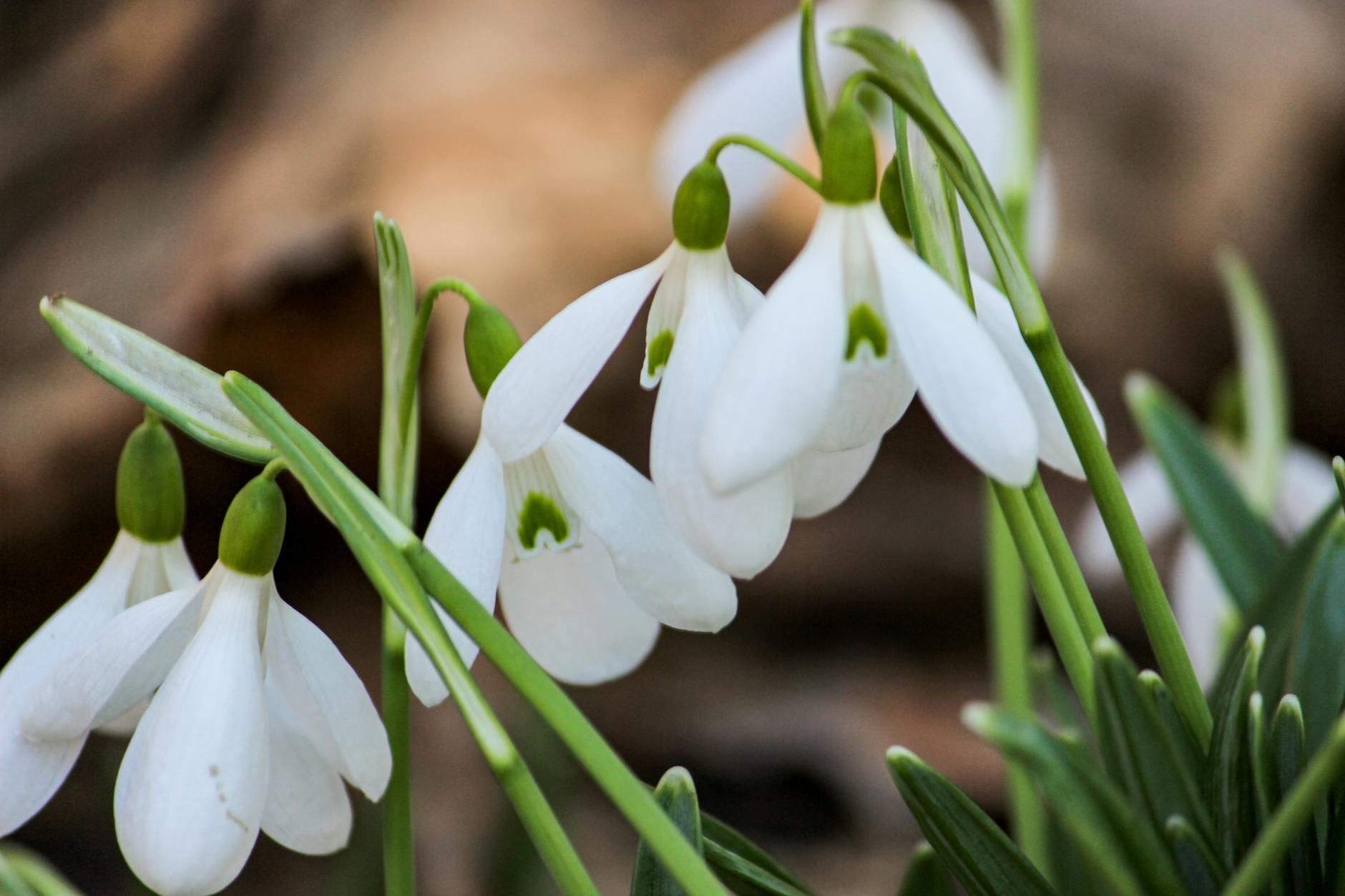 Why Are Early Symptoms of Cognitive Decline Often Missed?