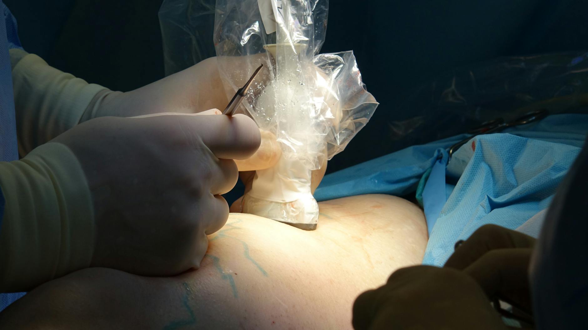 Why Do Experts Emphasize Greater Patient Awareness?