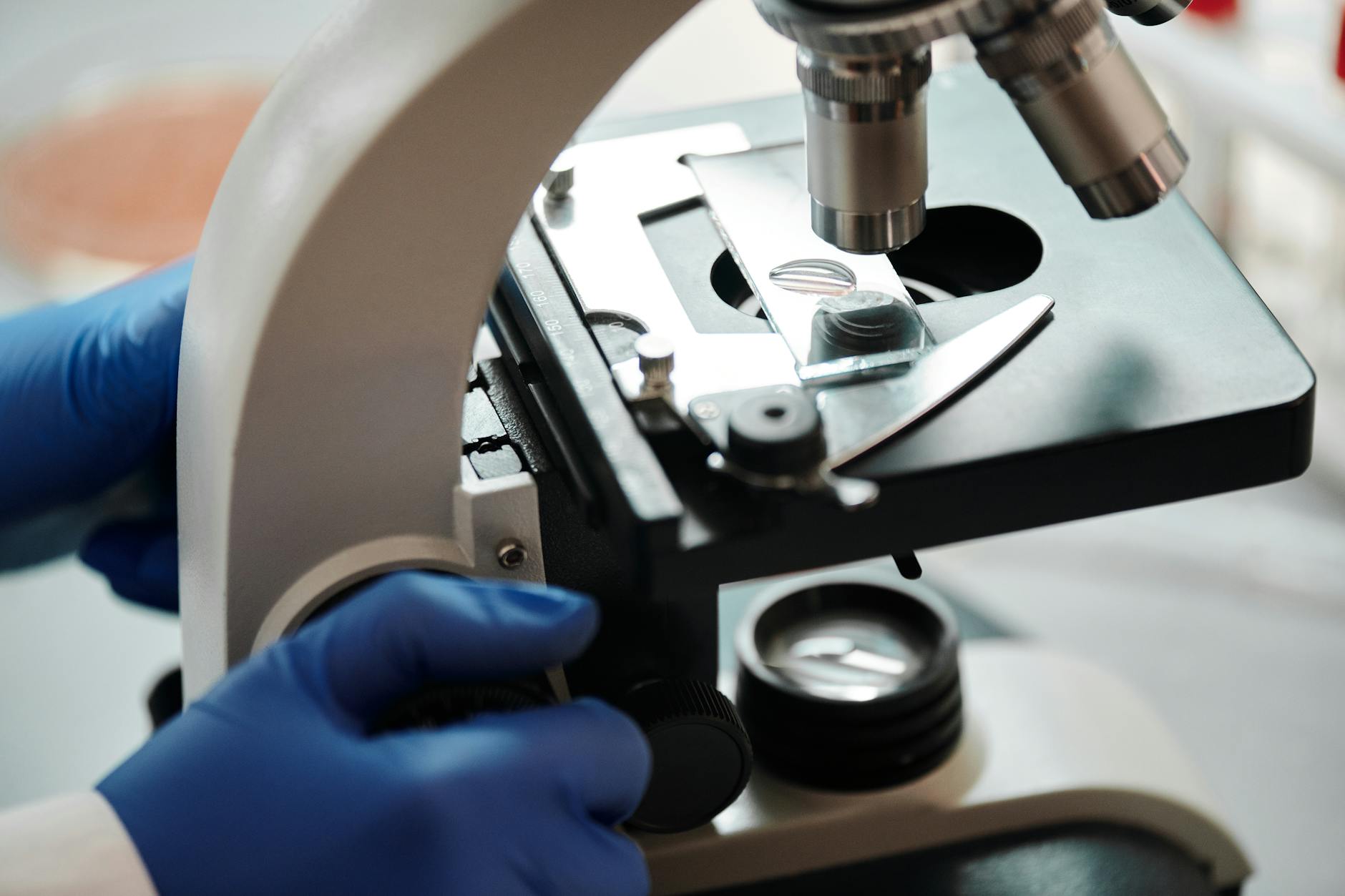 Why Do Researchers Emphasize Early Prevention Over Later Treatment?