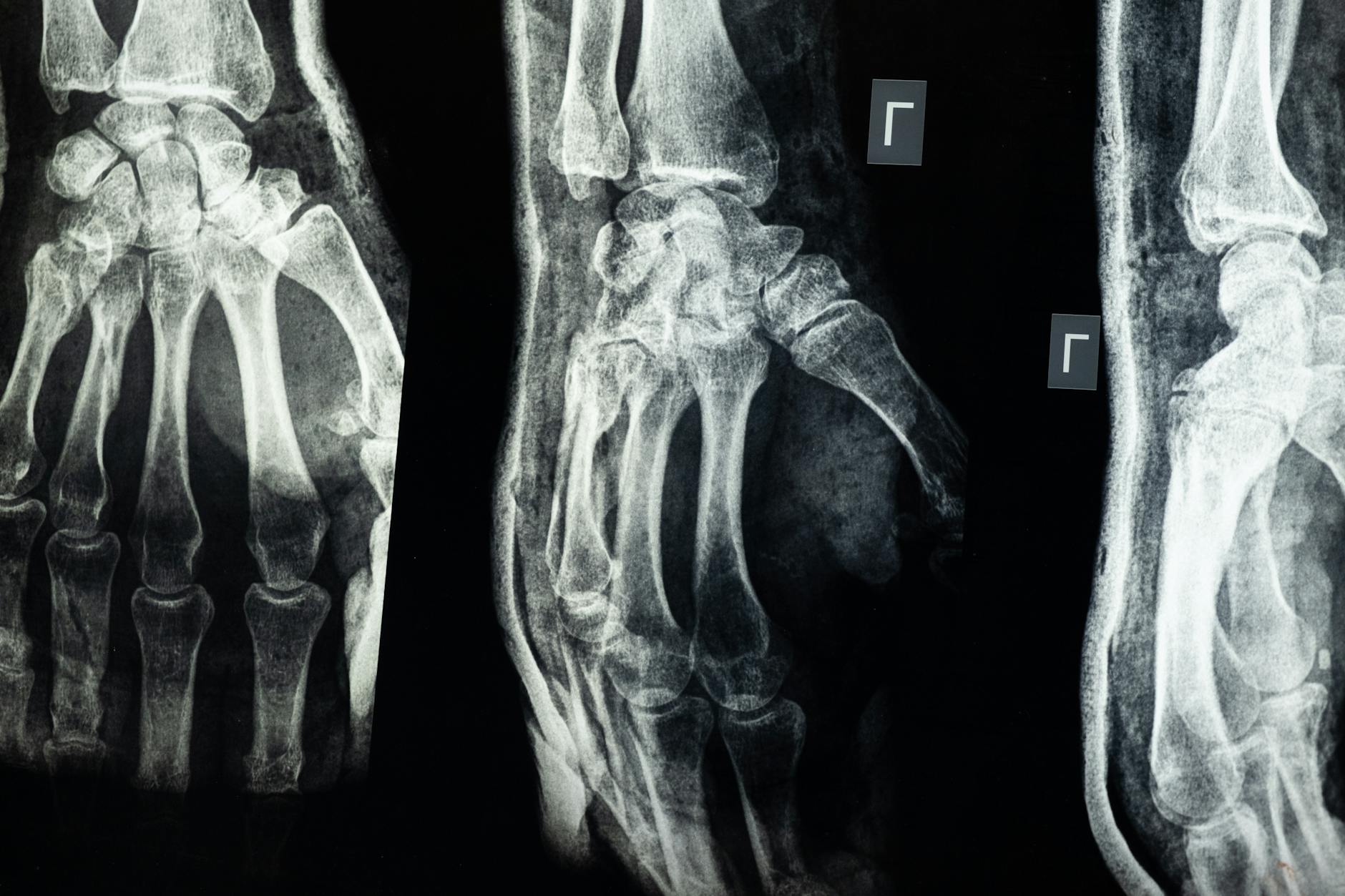Why Early Diagnosis Matters More Than You Might Think