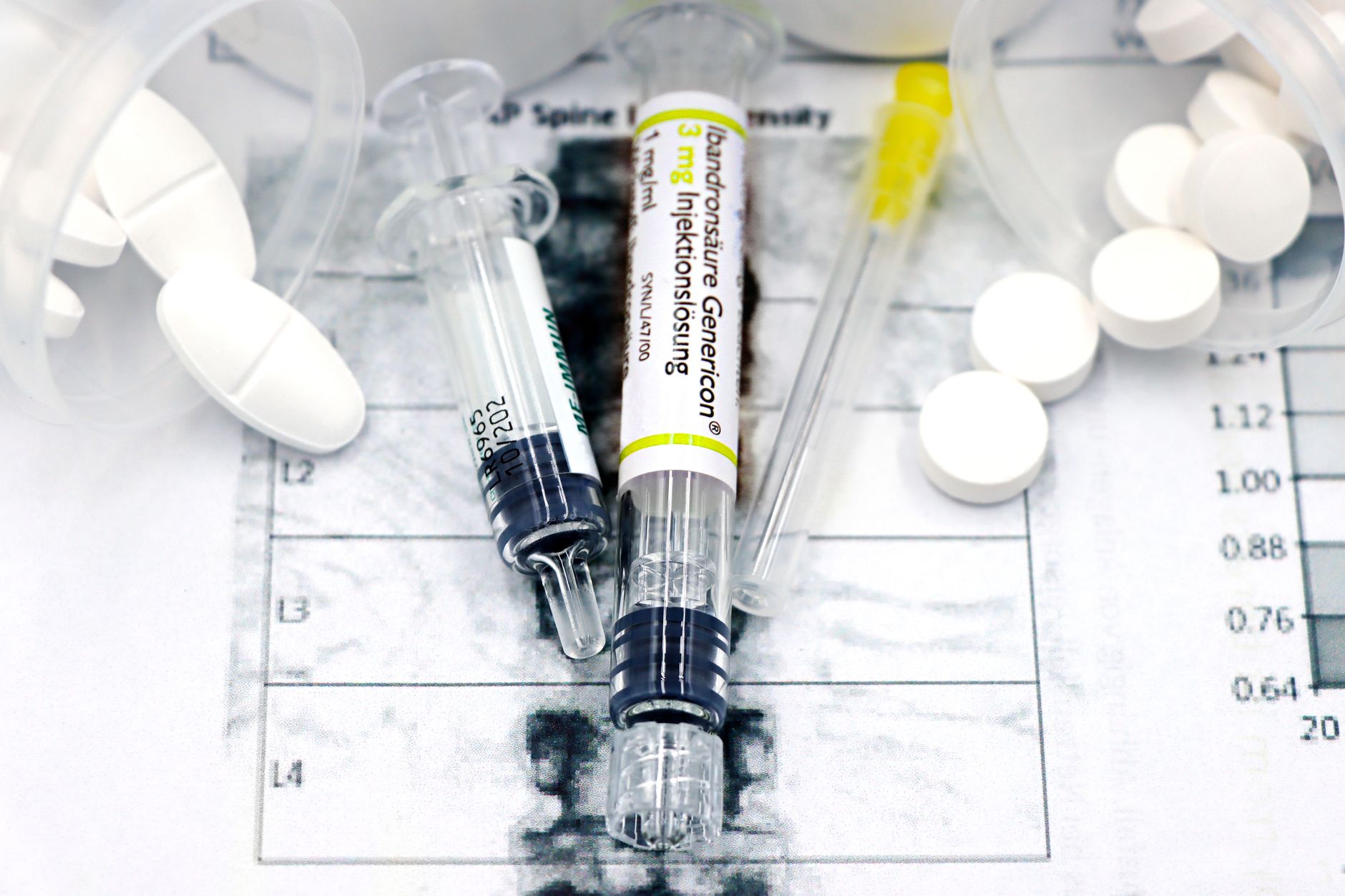 Blood Biomarkers Versus Cerebrospinal Fluid Testing—A Direct Comparison