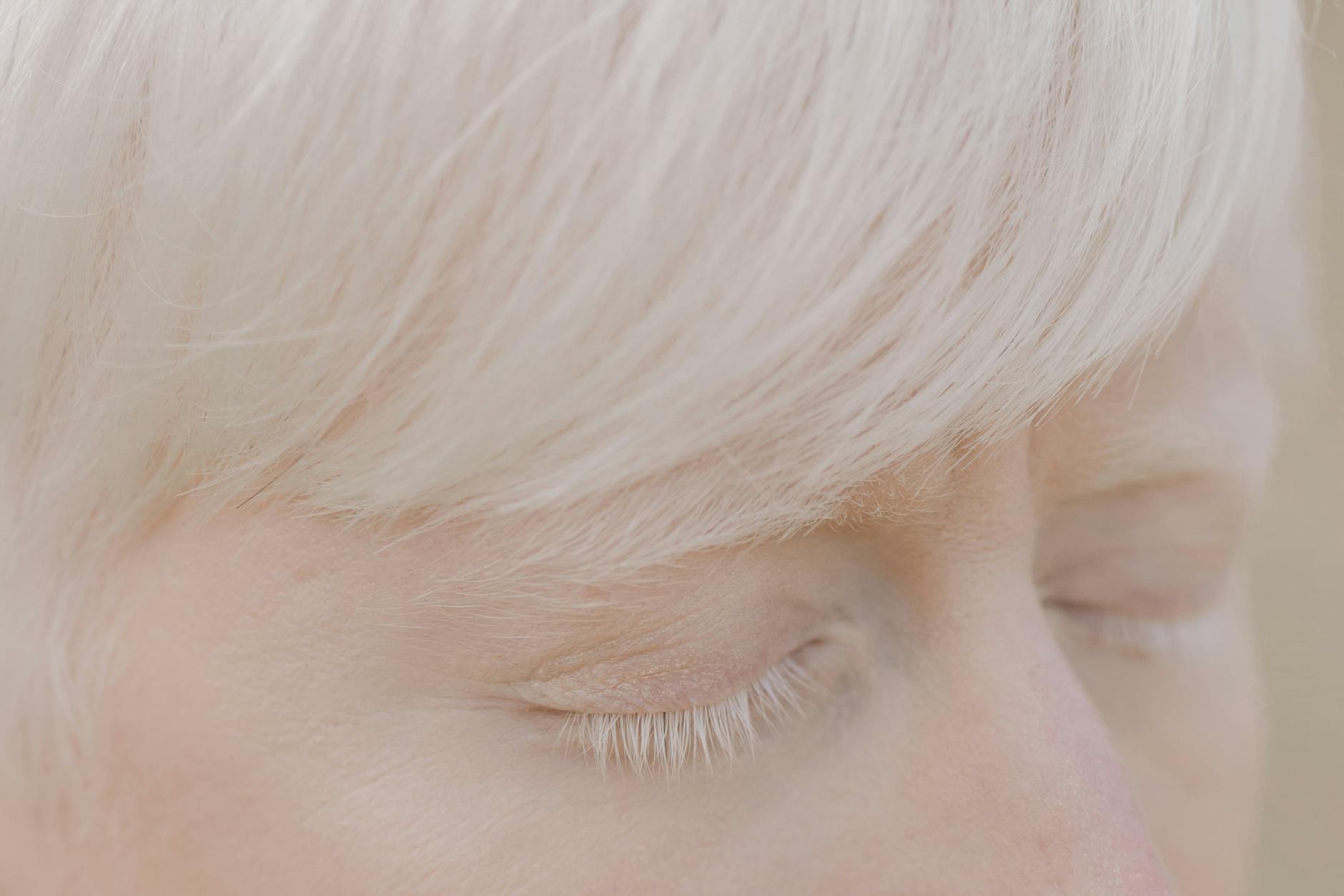 How Are Dementia Rates Changing and Why Do Families Need to Notice?