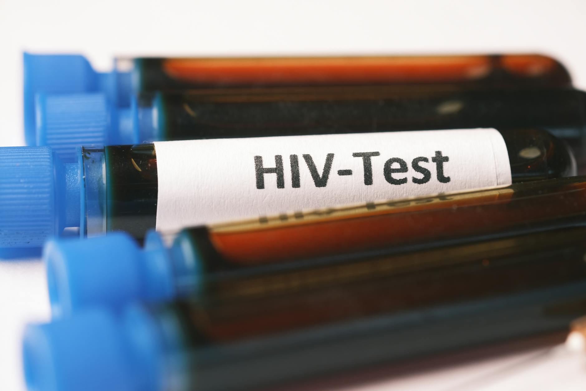How Blood Tests Compare to Traditional Diagnostic Methods