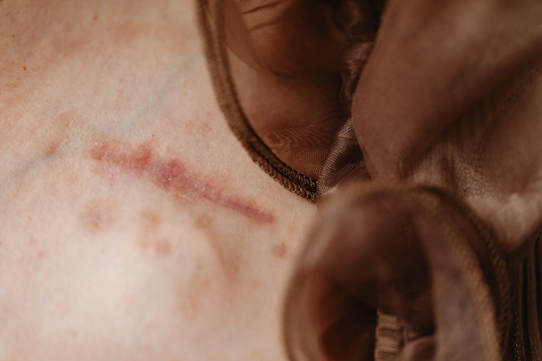 How Brain Injuries and Dementia Risk Connect in Veterans