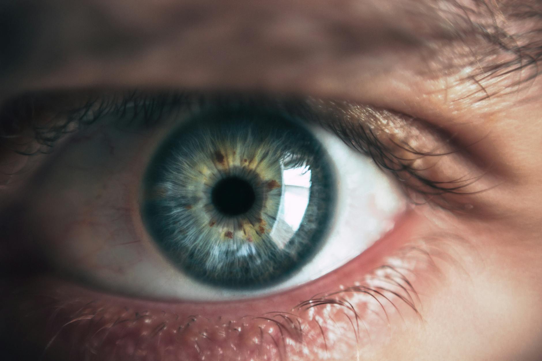 How Do Ketotifen Eye Drops Address Allergic Eye Symptoms?