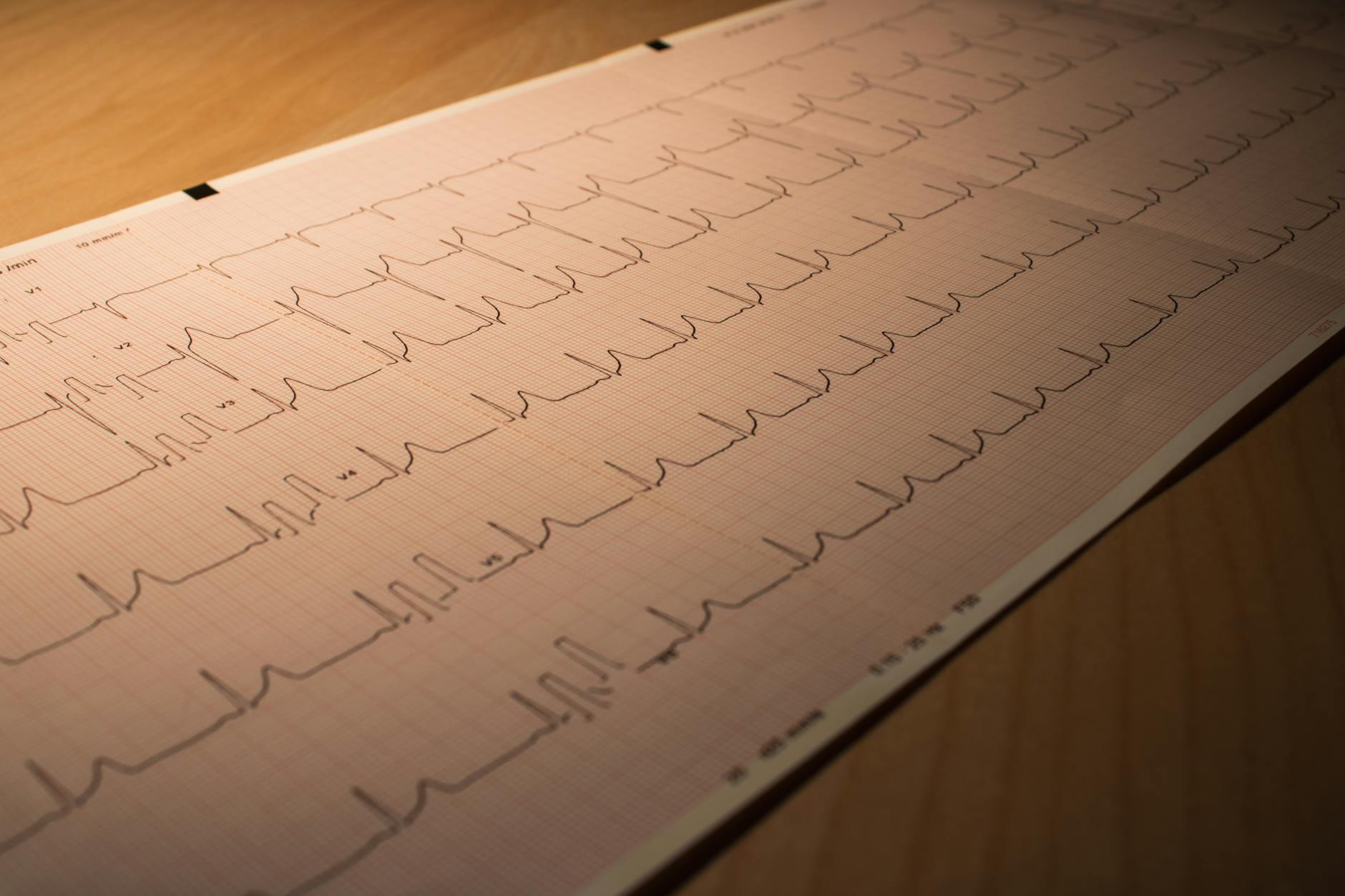 HOW DOES CARDIOVASCULAR DISEASE INCREASE ALZHEIMER'S RISK?