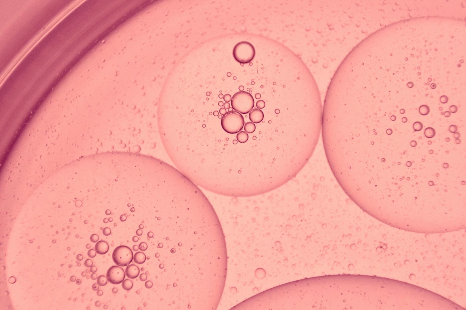 How Does Cholesterol Contribute to Amyloid Accumulation and Brain Pathology?