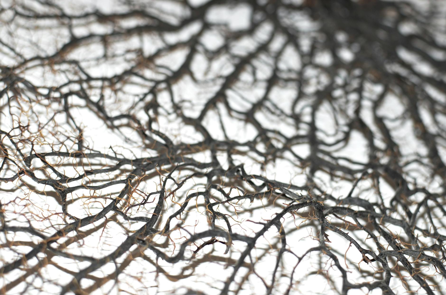 How Does Vascular Dementia Reduce Life Expectancy Compared to Alzheimer's?