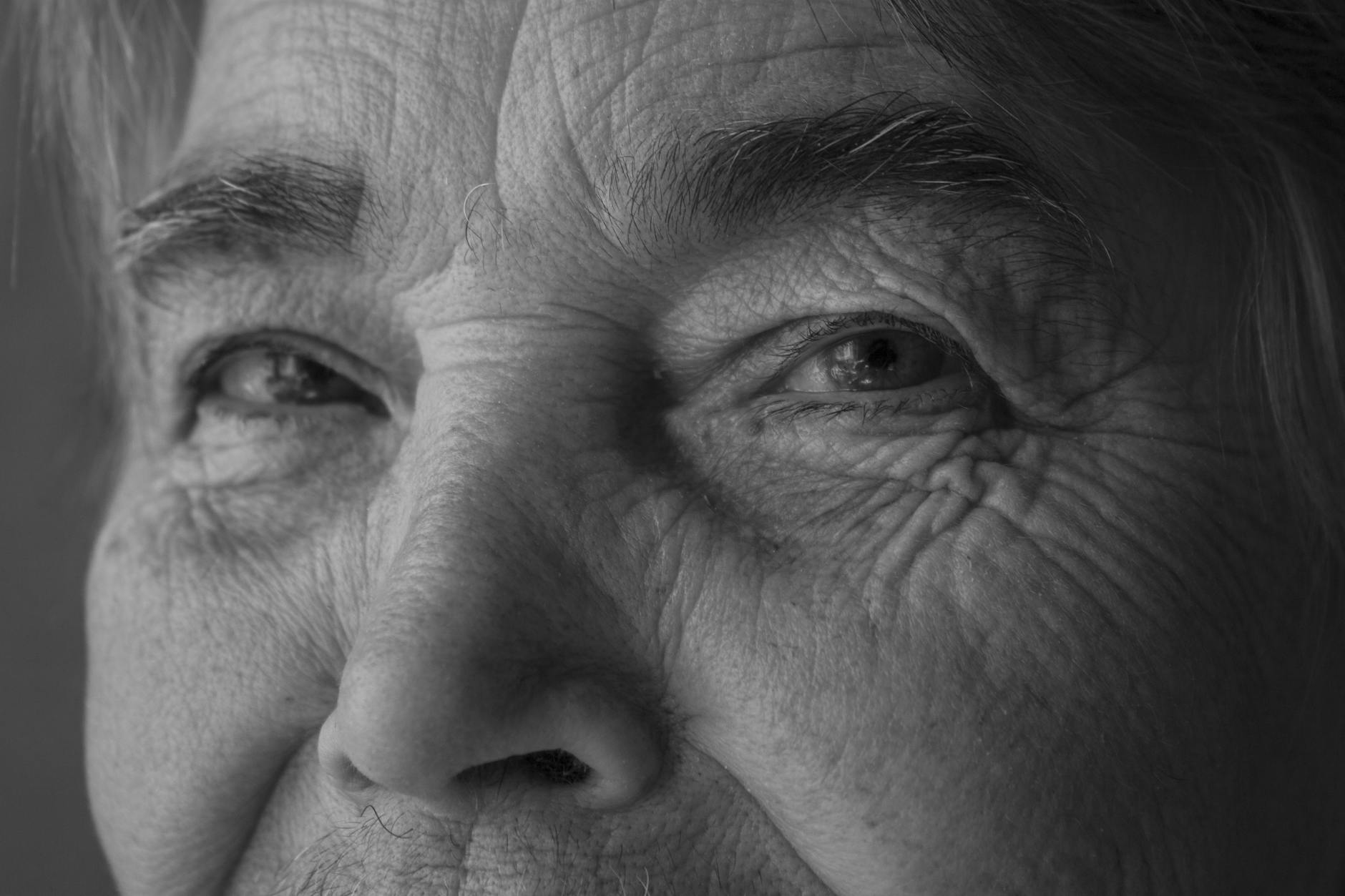 How Rapidly Is the Dementia Epidemic Growing?