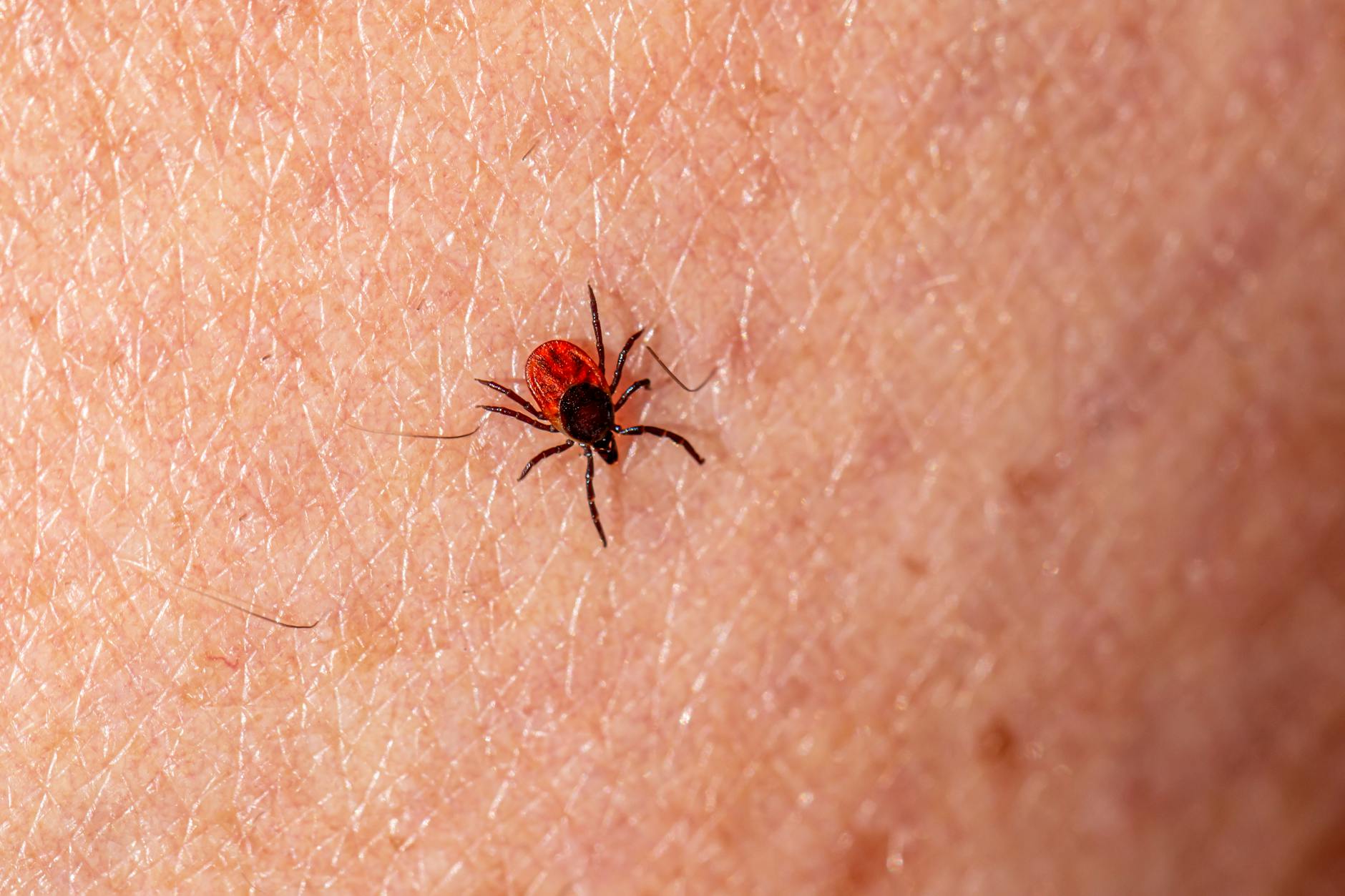 Identifying Small Vessel Disease and Vascular Dementia