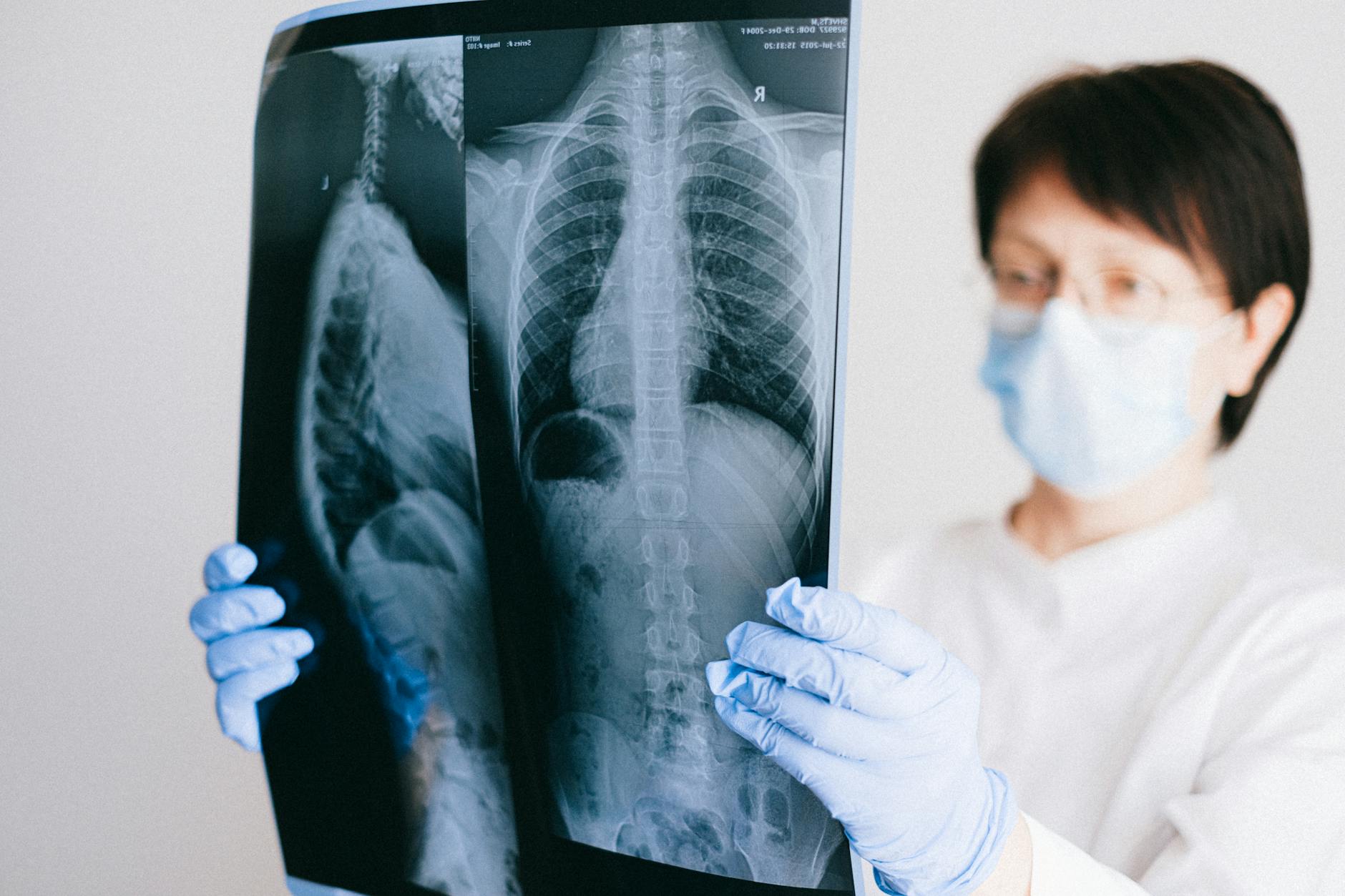 IMAGING LIMITATIONS AND THE RISKS OF OVERDIAGNOSIS