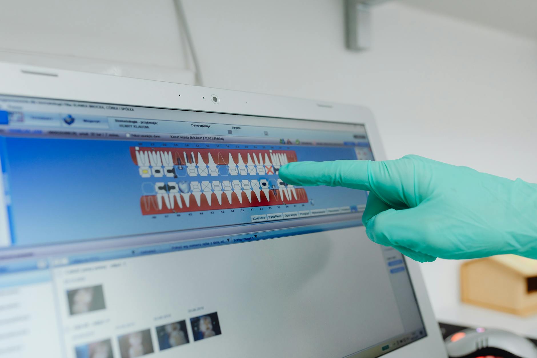The Agitation Pattern That Points to Dental Problems