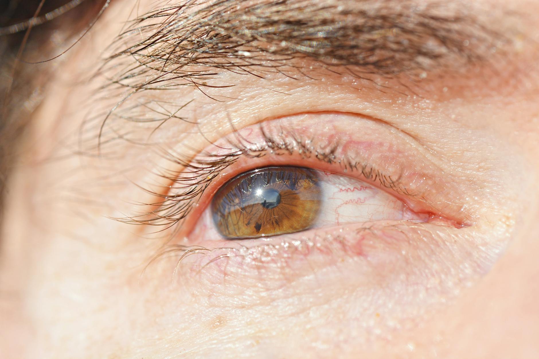 What Actually Causes Itchy Eyes and Why It Matters