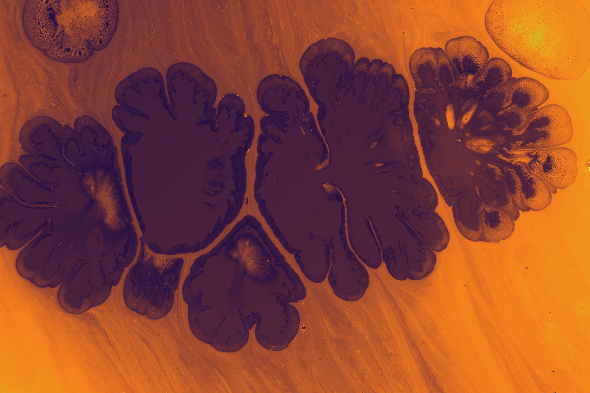 What Causes Encephalomalacia and Why Does It Appear on Brain Imaging?