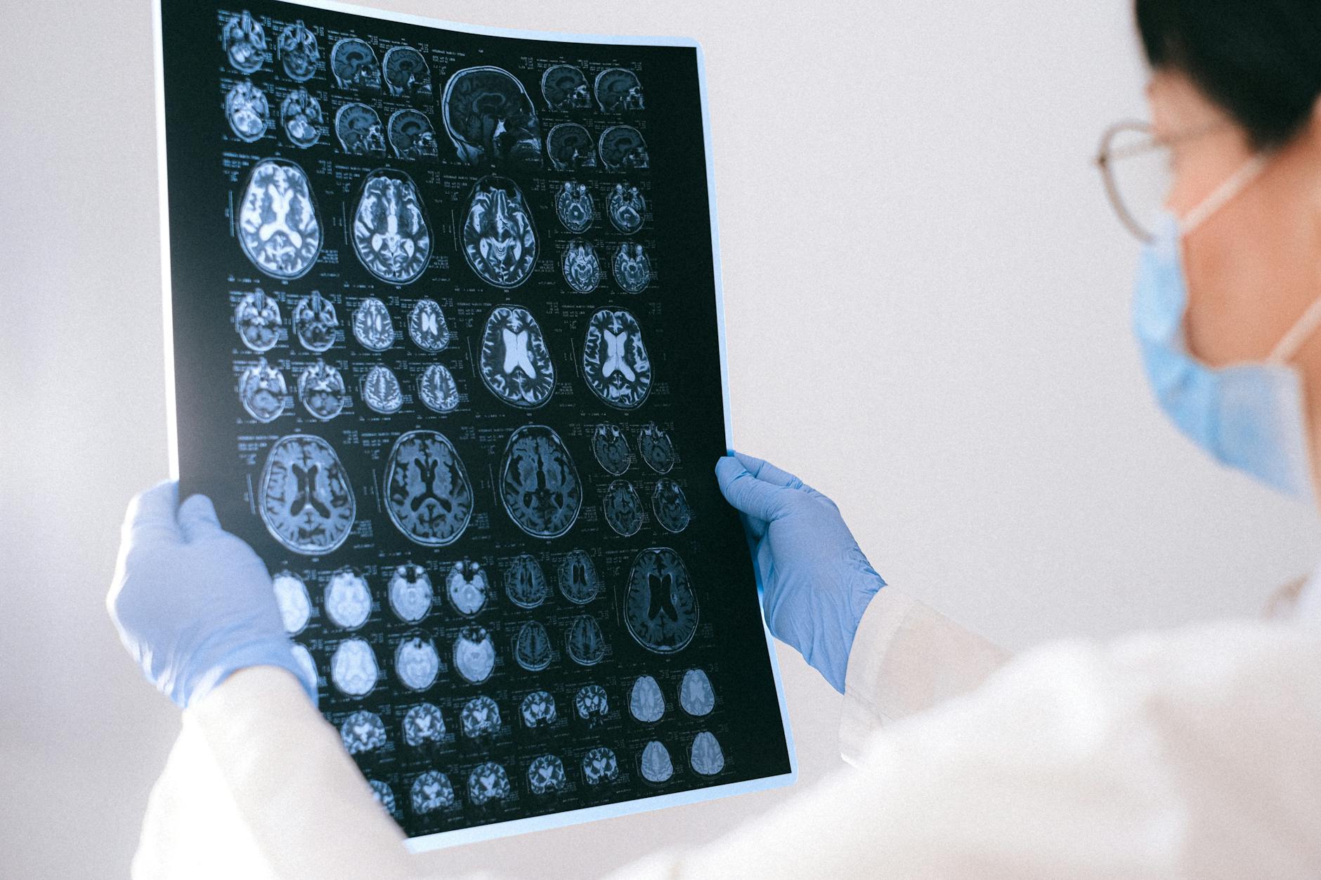 WHAT HAPPENS TO THE BRAIN DURING AND AFTER A STROKE?
