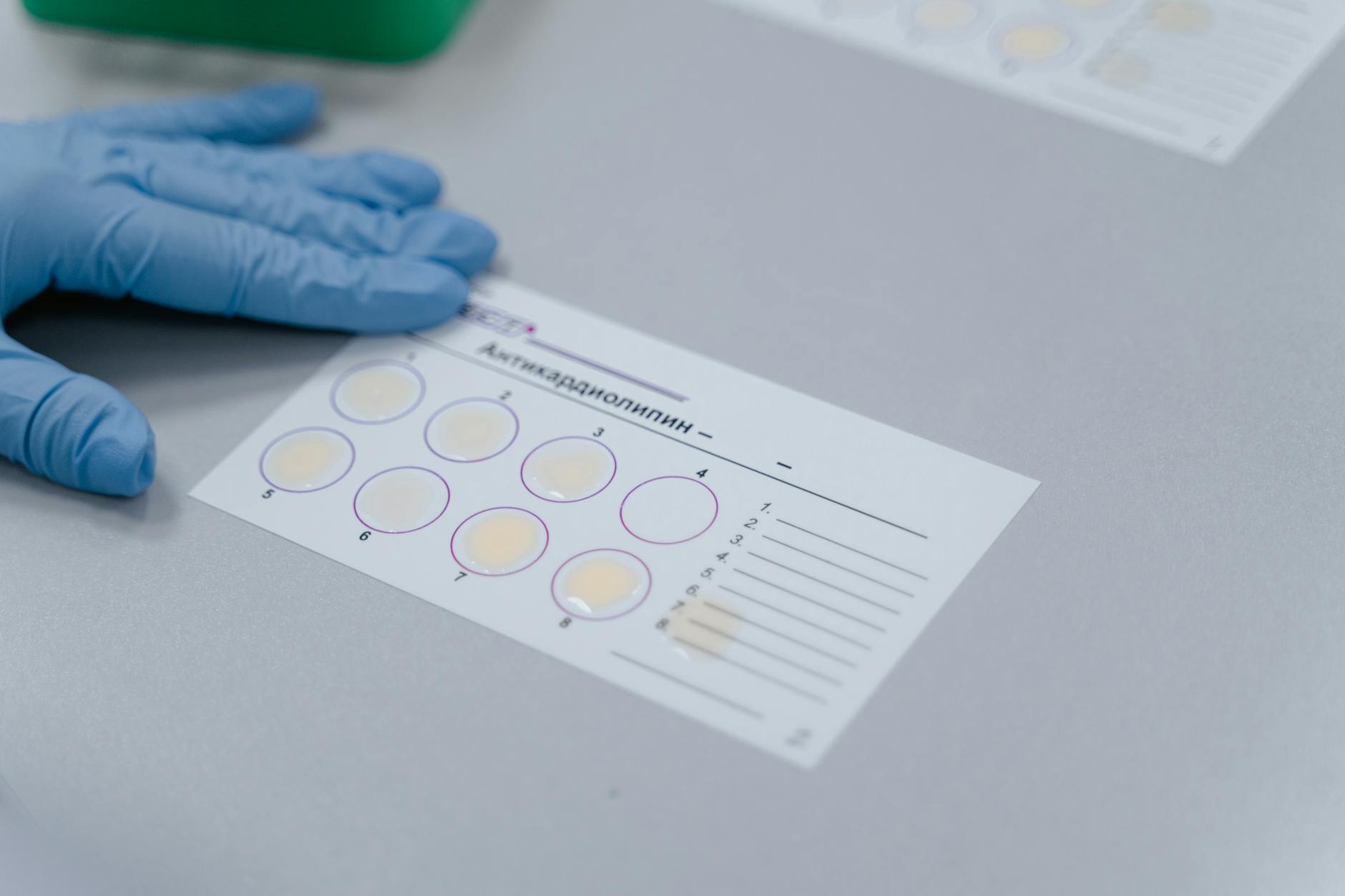 What Sensitivity and Specificity Tell Us About MMSE Accuracy