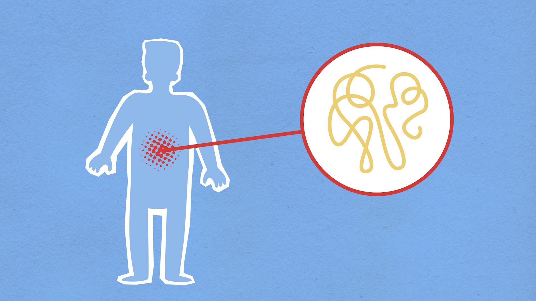 What Symptoms Should You Track Before a Doctor's Appointment?