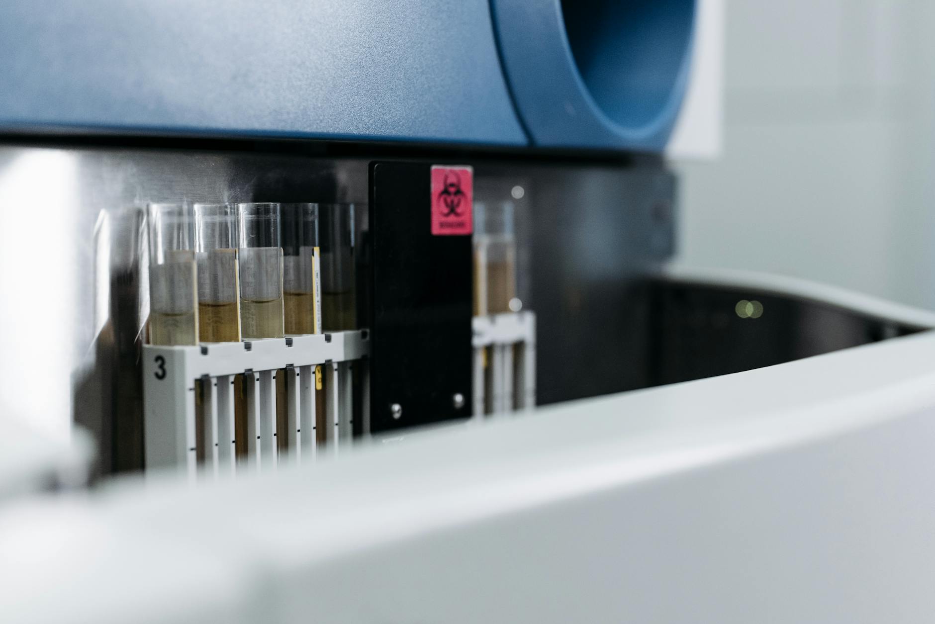 What You Need to Know About the Diagnostic Testing Process