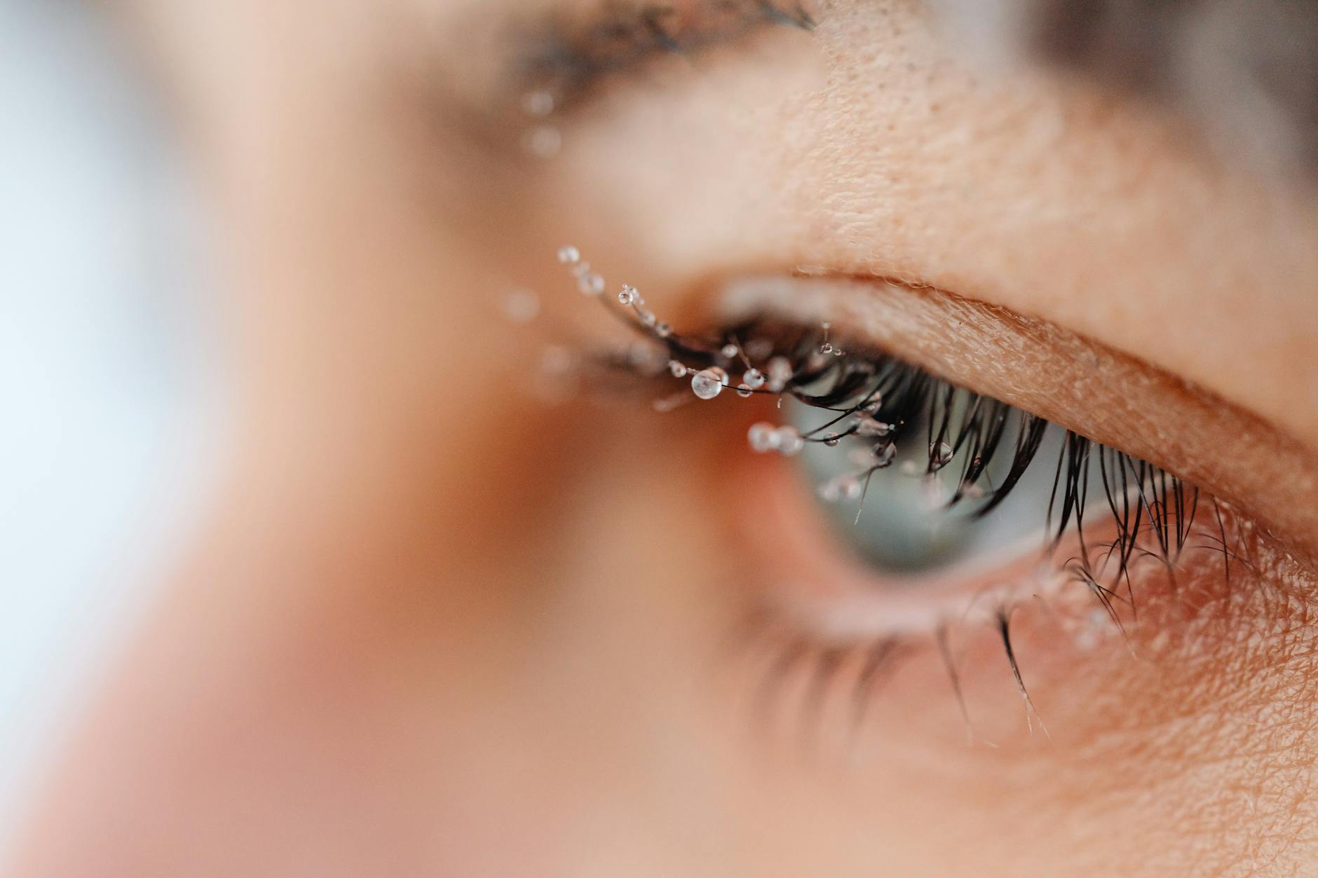 WHEN DOES A COLD'S EYE IRRITATION ACTUALLY START?