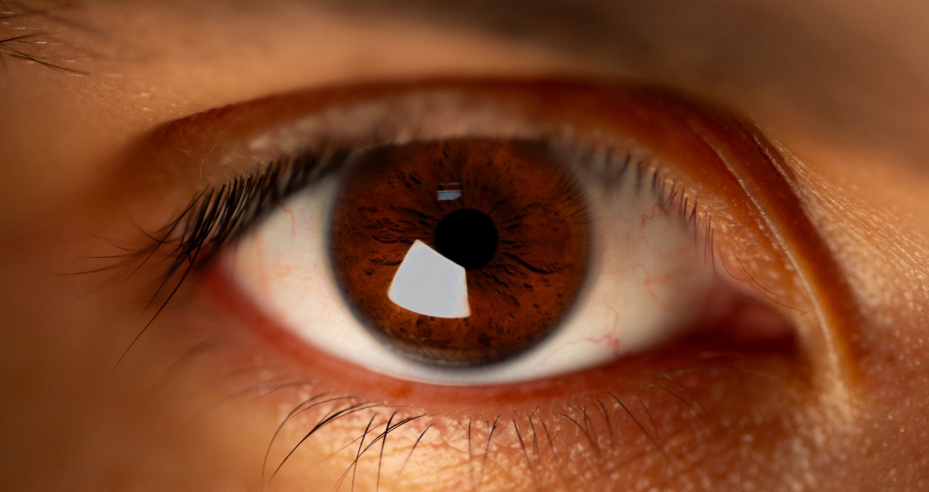 WHY DO EYES ITCH? UNDERSTANDING INFLAMMATION AND IBUPROFEN'S ROLE