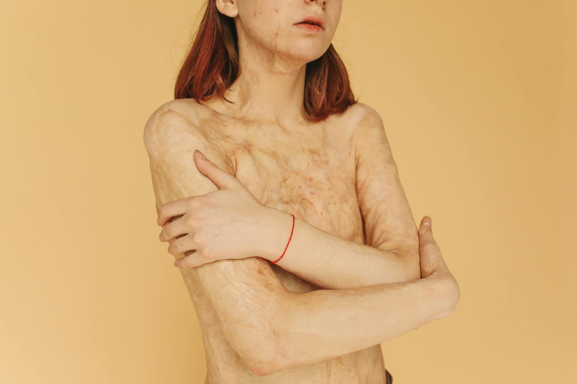 Your Baseline Eosinophilic Condition Doesn't Pause During Illness