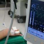 Can Hospital ICU Stays Affect Long-Term Cognition? - Featured image
