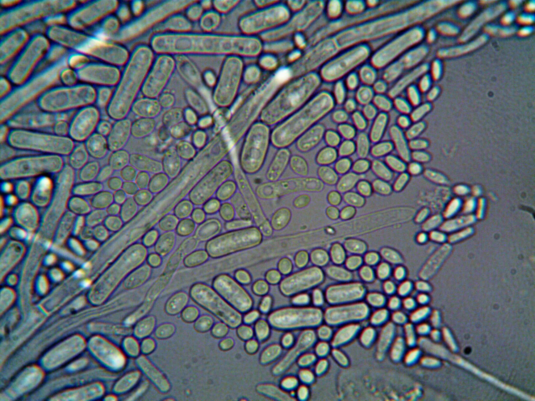 Neuroinflammation, Amyloid-Beta, and the Microbial Connection