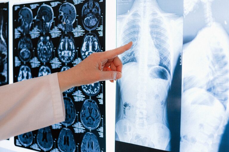Can a Brain MRI Show Alzheimer's Disease? - Featured image